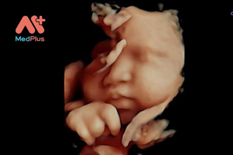 Siêu âm thai 5D là phương pháp sử dụng sóng siêu âm để quan sát chuyển động của thai nhi trong tử cung