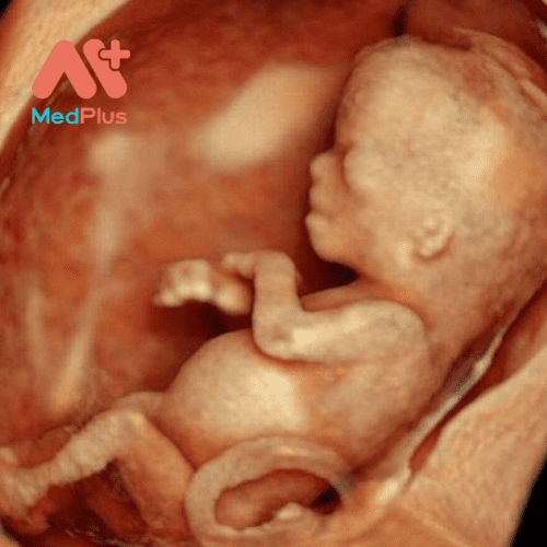 siêu âm thai 3D được các bác sĩ khuyến khích thực hiện vào các mốc quan trọng của thai kỳ