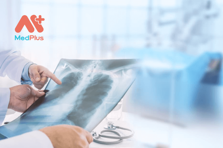 gian phe thung 1 - Medplus