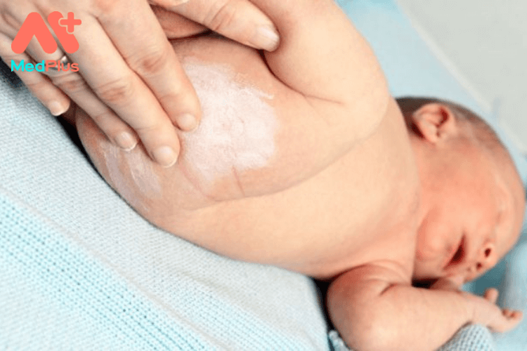 Phương pháp chữa hăm cho trẻ sơ sinh