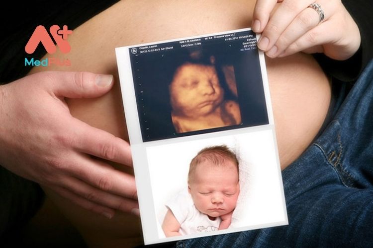 Siêu âm 4D giúp quan sát trực tiếp hình ảnh và hoạt động của thai nhi tại thời điểm siêu âm