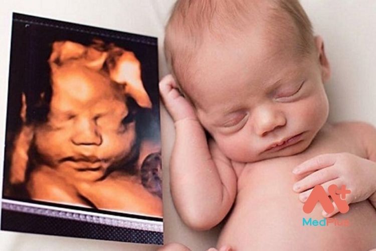 Siêu âm thai 4D là phương thức tái tạo hình ảnh động của em bé bên trong tử cung của người mẹ