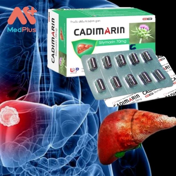 Thuốc Cadimarin hỗ trợ điều trị viêm gan cấp và mạn tính