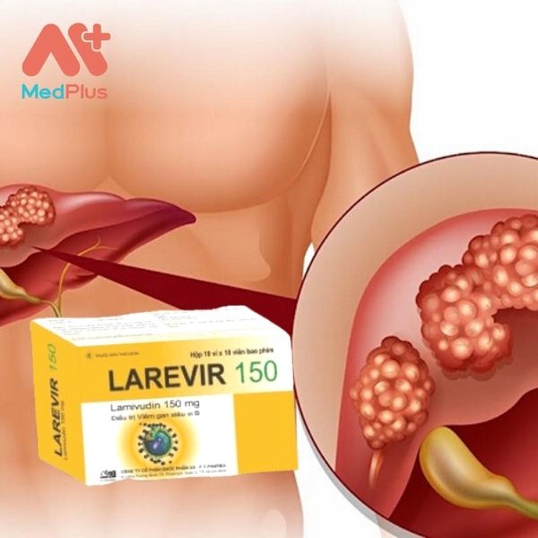 Thuốc Larevir 150 điều trị viêm gan siêu vi B
