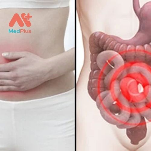 Đau bụng là đau ở bất cứ vị trí nào giữa ngực và vùng bẹn.