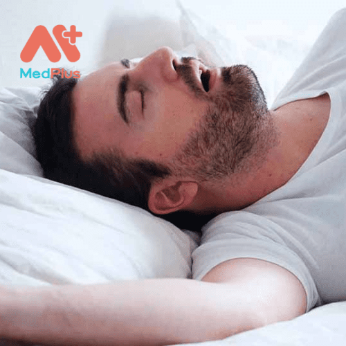 Ngưng thở khi ngủ trung ương là một chứng rối loạn thở xảy ra trong khi ngủ
