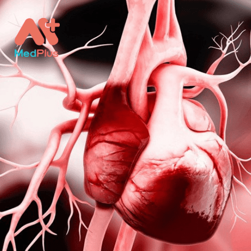 Suy tim cấp tính là sự phát triển đột ngột của các dấu hiệu và triệu chứng của suy tim