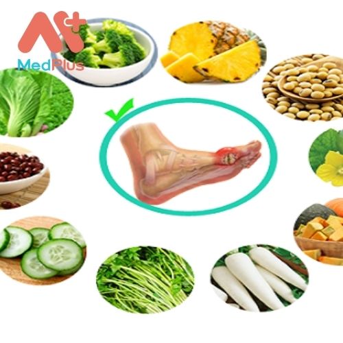 Chế độ dinh dưỡng cho bệnh gout
