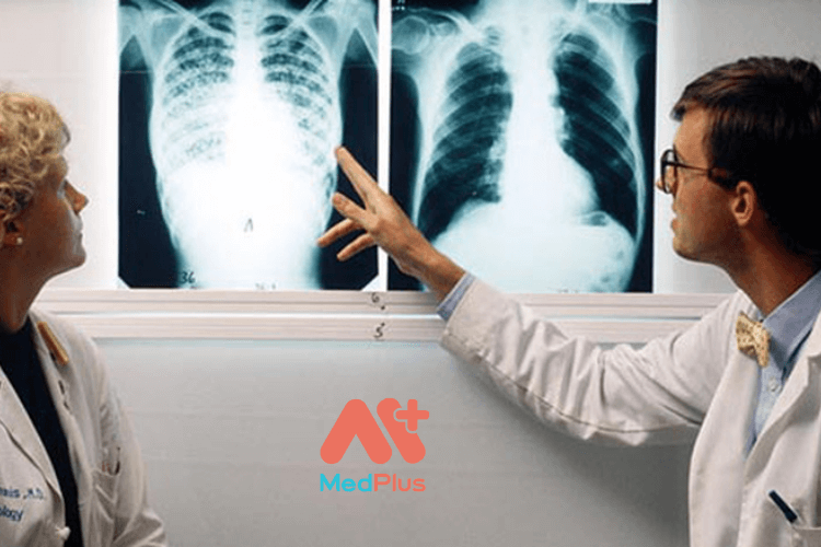 6 biến chứng phổ biến của bệnh lao phổi