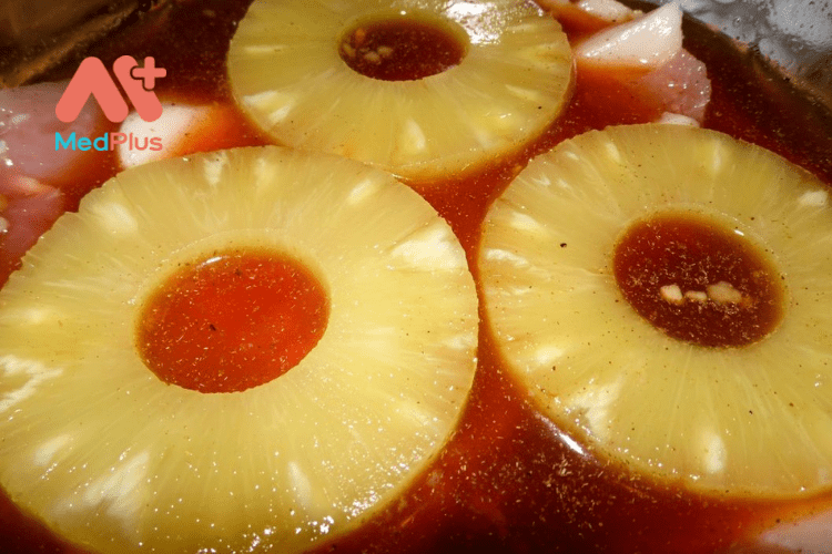 moi ban 12 1 - Medplus