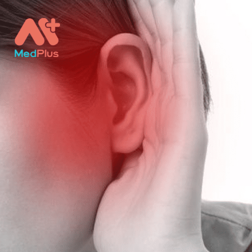 Các triệu chứng mất thính giác có thể thay đổi từ nhẹ đến nặng.