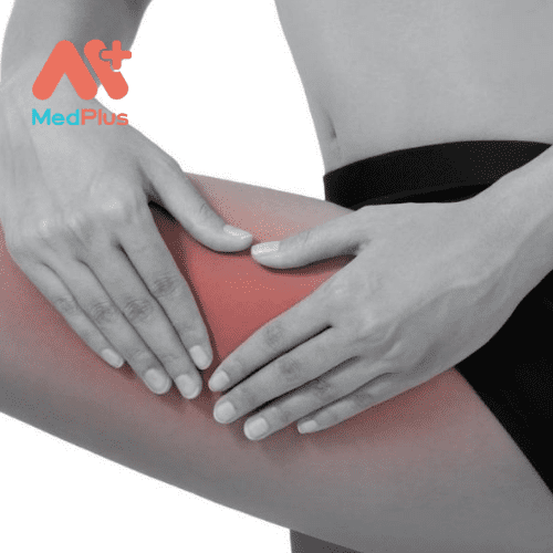 Có nhiều nguyên nhân khác nhau gây ra đau đùi