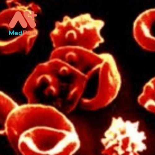 Rối loạn tăng sinh tủy gây ra sản xuất dư thừa các tế bào hồng cầu hoặc bạch cầu hoặc tiểu cầu