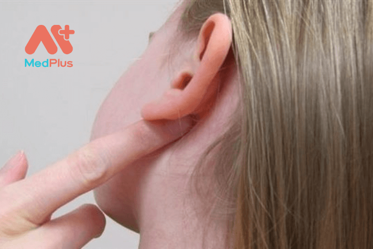 Hiện tượng nổi hạch sau tai là gì?