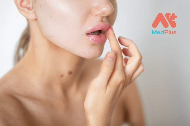 tay te bao chet moi 1 - Medplus