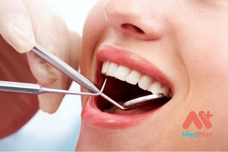 Viền chân răng bị đen: Nguyên nhân và cách khắc phục hiệu quả