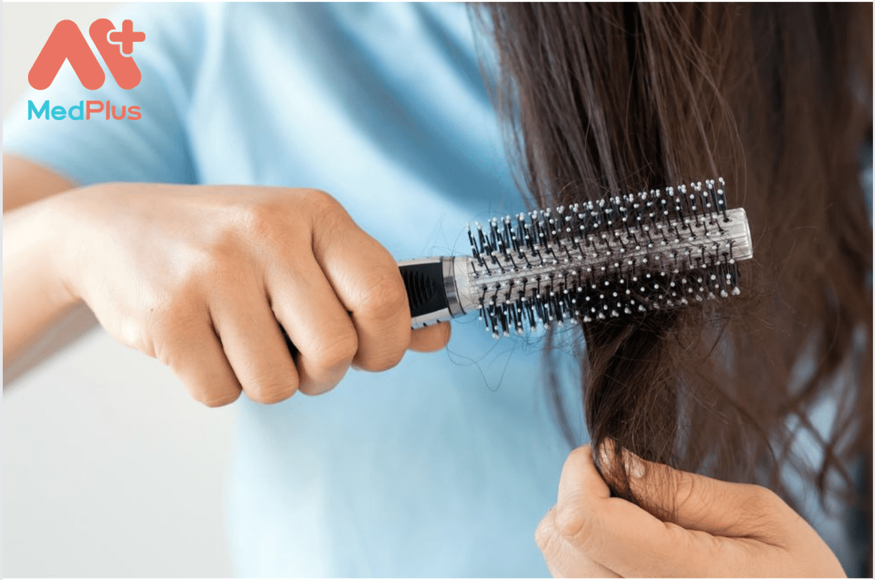 Hiện tượng rụng tóc sau sinh có đáng lo ngại