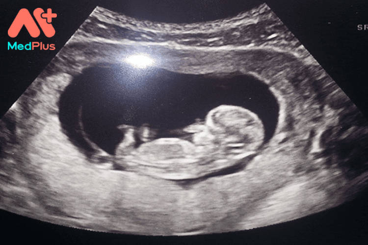 Sự phát triển của thai nhi 11 tuần tuổi