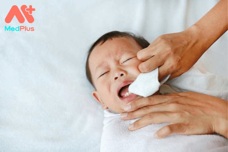 8 cách trị nhiệt miệng cho trẻ sơ sinh