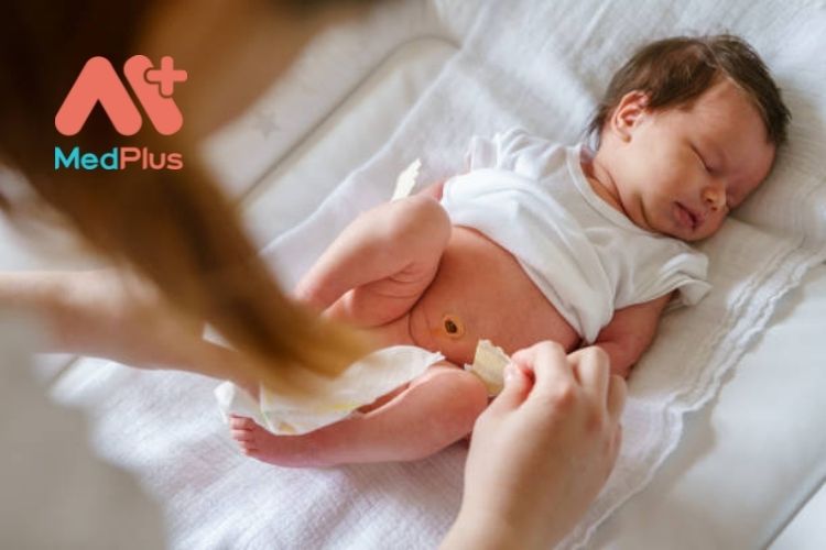 Chăm sóc phần cuống rốn của trẻ sơ sinh