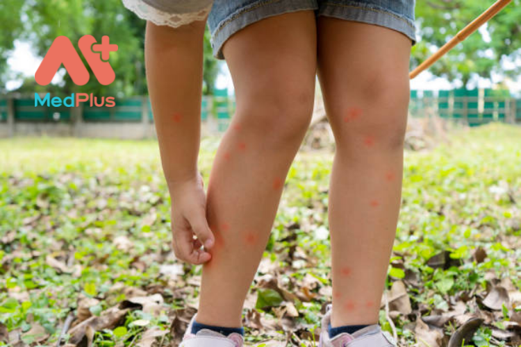 Loại thuốc xịt côn trùng không an toàn cho trẻ