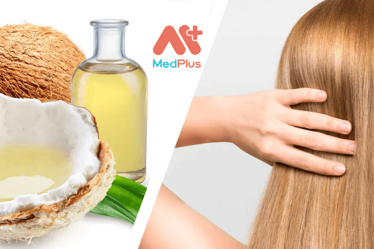 Tiết lộ 5 cách trị gàu bằng dầu dừa lành tính cho mái tóc
