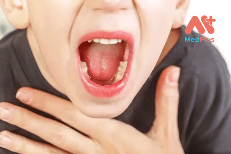Viêm họng hạt có mủ nguy hiểm không?