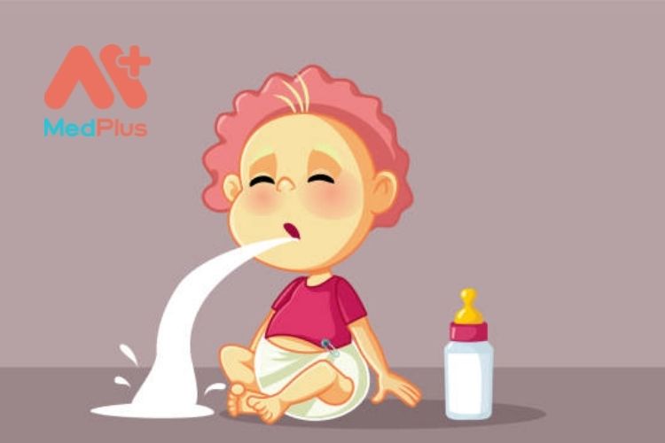 Cách điều trị trào ngược axit ở trẻ 130 Các dấu hiệu của trào ngược axit ở trẻ sơ sinh