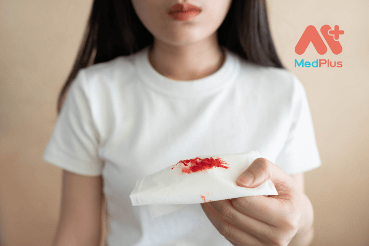 khac dom co mau 2 1 - Medplus