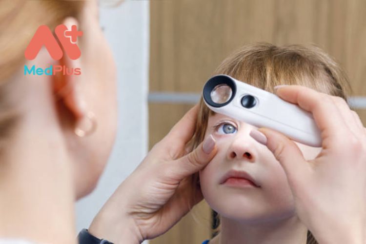 Các vấn đề về mắt thường gặp ở trẻ em