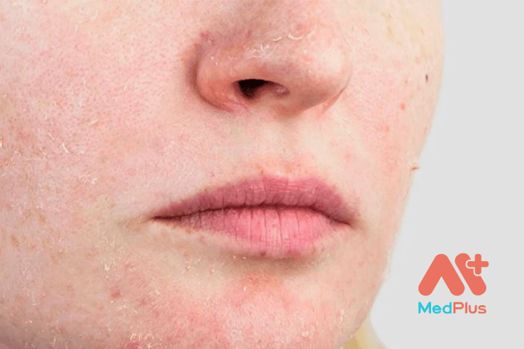 da nhay cam 2 1 - Medplus