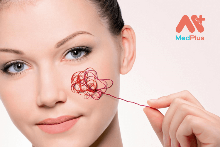 Da nhạy cảm là loại da như thế nào?