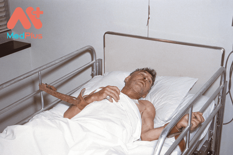 Bệnh dại ở người và top 12 bài viết mới nhất 2022