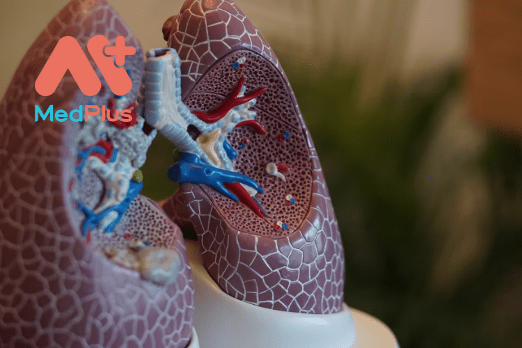 Tràn dịch màng phổi vô cùng nguy hiểm