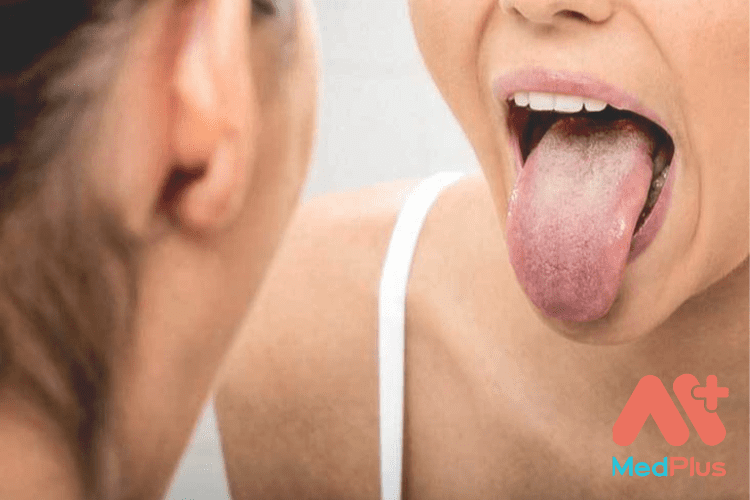 Ung thư lưỡi và 10 bài viết hữu ích nhất 2022