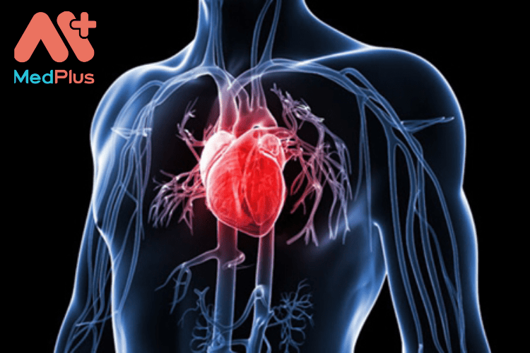 [TOP 10] bài viết về Thiếu máu cục bộ cơ tim hữu ích 2022