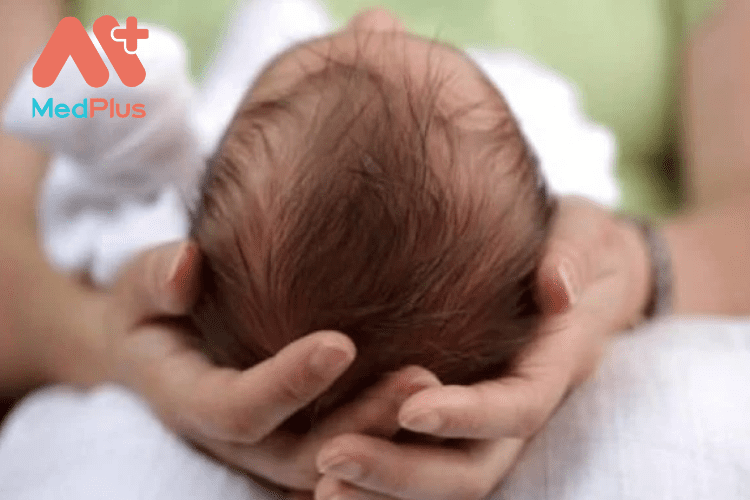 Tóc máu của trẻ sơ sinh và TOP 10 bài viết đáng đọc thử 2022