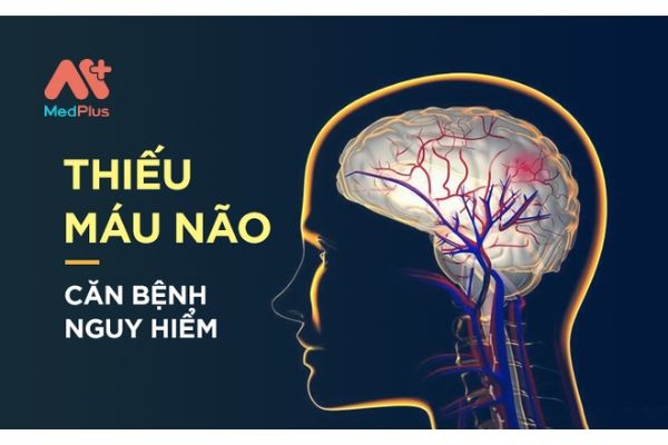 thiếu máu não