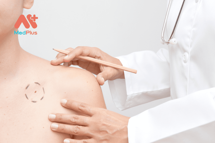 CÁCH TỰ KIỂM TRA DA ĐỂ TẦM SOÁT UNG THƯ DA TẠI NHÀ