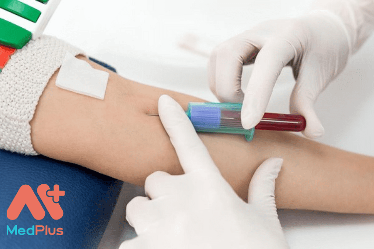 Danh sách 10 bài viết về Xét nghiệm máu đáng đọc 2022