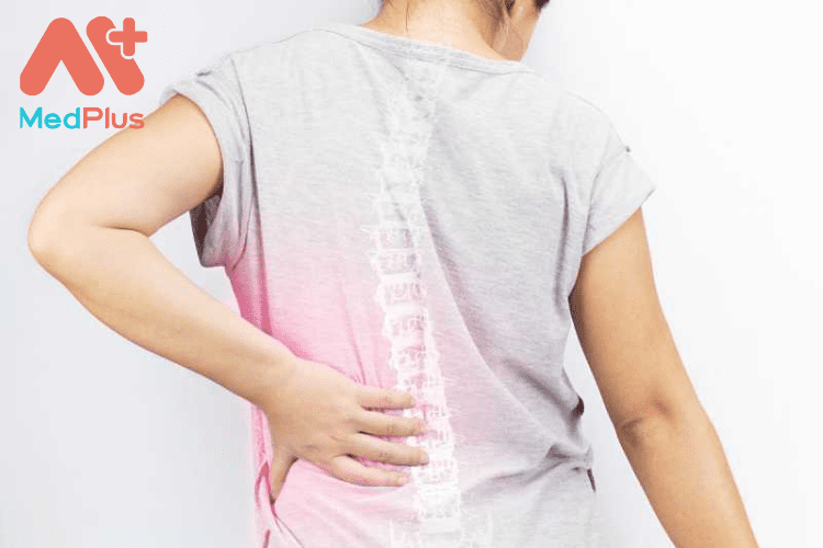 Tổng hợp 10 bài viết về Hẹp ống sống đáng đọc 2022