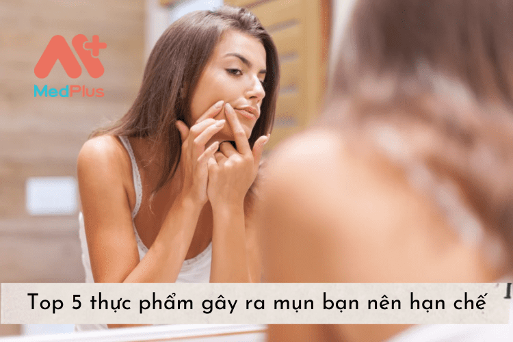 Top 5 thực phẩm gây ra mụn bạn nên hạn chế