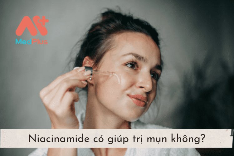 Niacinamide có giúp trị mụn không?