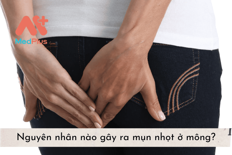 Nguyên nhân nào gây ra mụn nhọt ở mông?