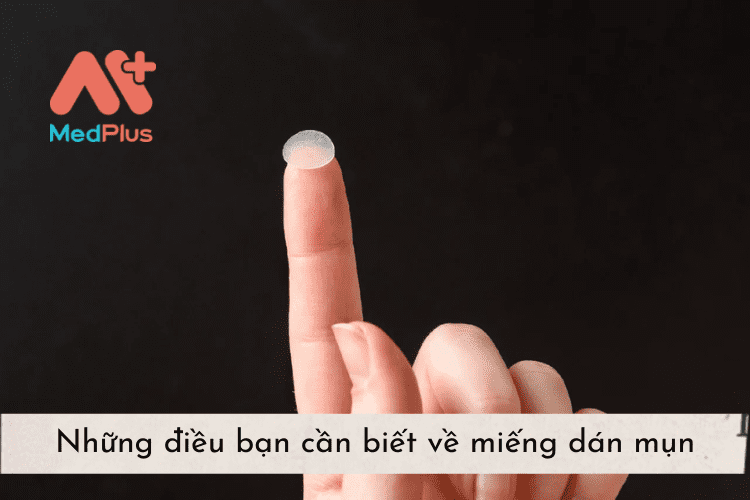 Những điều bạn cần biết về miếng dán mụn