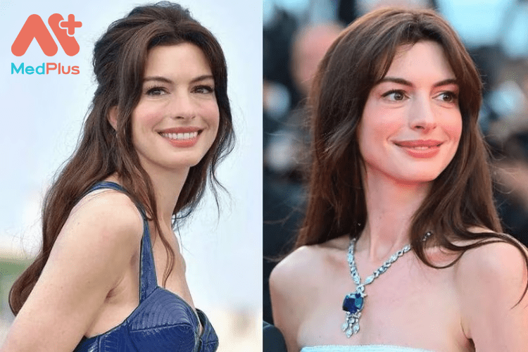 Hình ảnh của nữ diễn viên Anne Hathaway