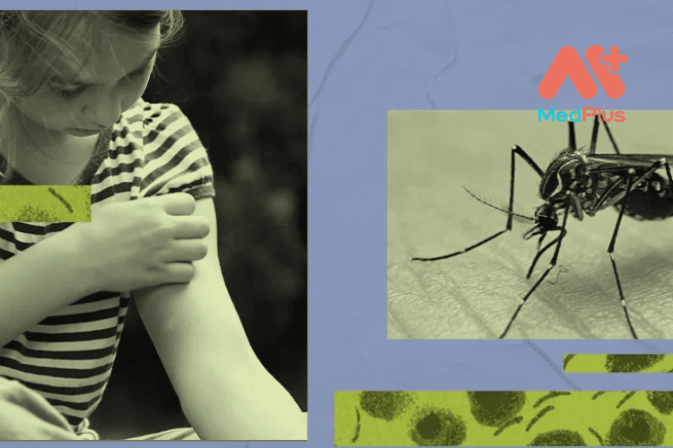 Sốt xuất huyết Dengue là bệnh truyền nhiễm cấp tính do virus lây truyền qua muỗi, gây các triệu chứng giống như cúm nặng