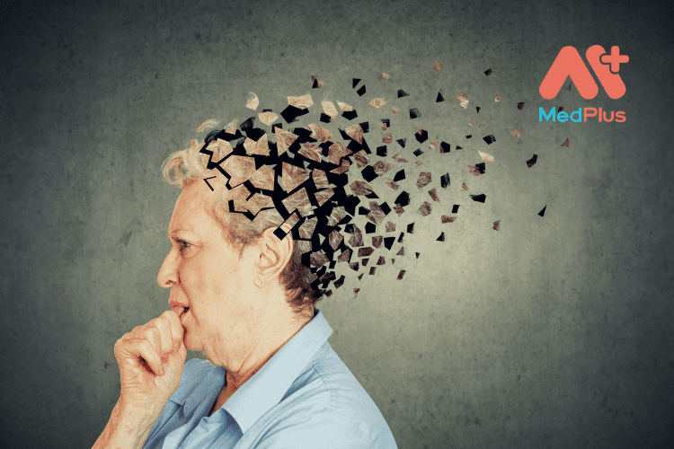 Bệnh Alzheimer là một rối loạn thần kinh tiến triển chủ yếu ảnh hưởng đến người lớn tuổi