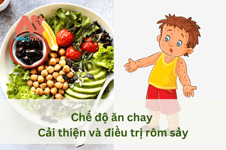 Chế độ ăn chay cung cấp nhiều dinh dưỡng giúp người bị rôm sảy nhanh hết bệnh 