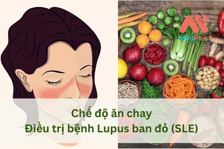 Chế độ ăn chay điều trị bệnh Lupus ban đỏ (SLE) như thế nào